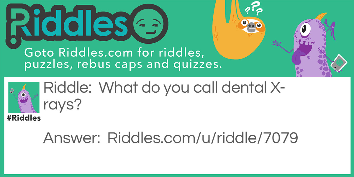 Riddle: What do you call dental X-rays? Answer: Tooth-Pics.